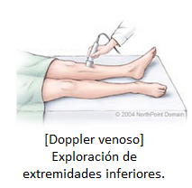 doppler venoso