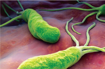 Bacteria del Helicobacter Pylori