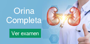 Orina Completa